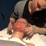 Melbourne skin needling